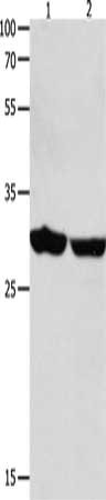 Gel: 12%SDS-PAGE, Lysate: 40 μg, Lane 1-2: Human brain malignant glioma tissue, Human laryngocarcinoma tissue, Primary antibody: YWHAE Antibody(YWHAE Antibody) at dilution 1/1300, Secondary antibody: Goat anti rabbit IgG at 1/8000 dilution, Exposure time: 30 secondsRabbit anti-Human YWHAE Polyclonal Antibody
