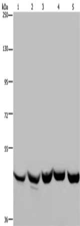 Gel: 6%SDS-PAGE, Lysate: 40 μg, Lane 1-5: NIH/3T3 cells, A172 cells, HepG2 cells, K562 cells, Hela cells, Primary antibody: YARS2 Antibody(YARS2 Antibody) at dilution 1/250, Secondary antibody: Goat anti rabbit IgG at 1/8000 dilution, Exposure time: 30 secondsRabbit anti-Human YARS2 Polyclonal Antibody