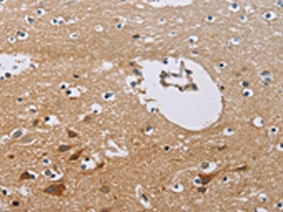 The image on the left is immunohistochemistry of paraffin-embedded Human brain  tissue using INHBA Antibody(INHBA Antibody) at dilution 1/30, on the right is treated with fusion protein. (Original magnification: ×200)