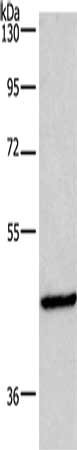 Gel: 8%SDS-PAGE, Lysate: 40 μg, Lane: Mouse fat tissue, Primary antibody: INHBA Antibody(INHBA Antibody) at dilution 1/701, Secondary antibody: Goat anti rabbit IgG at 1/8000 dilution, Exposure time: 1 minute