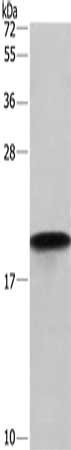 Gel: 10%SDS-PAGE, Lysate: 40 μg, Lane: Hela cells, Primary antibody: PPIF Antibody(PPIF Antibody) at dilution 1/675, Secondary antibody: Goat anti rabbit IgG at 1/8000 dilution, Exposure time: 30 secondsRabbit anti-Human PPIF Polyclonal Antibody