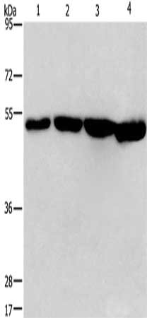 Gel: 8%SDS-PAGE, Lysate: 40 μg, Lane 1-4: A431 cells, A375 cells, hela cells, Jurkat cells, Primary antibody: MAF Antibody(MAF Antibody) at dilution 1/1100, Secondary antibody: Goat anti rabbit IgG at 1/8000 dilution, Exposure time: 5 seconds