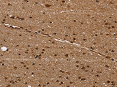 The image on the left is immunohistochemistry of paraffin-embedded Human brain  tissue using EIF3H Antibody(EIF3H Antibody) at dilution 1/50, on the right is treated with fusion protein. (Original magnification: ×200)Rabbit anti-Human EIF3H Polyclonal Antibody