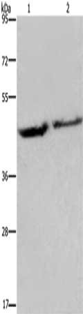 Gel: 8%SDS-PAGE, Lysate: 40 μg, Lane 1-2: Human adrenal pheochromocytoma tissue, Human fetal brain tissue, Primary antibody: EIF3H Antibody(EIF3H Antibody) at dilution 1/1150, Secondary antibody: Goat anti rabbit IgG at 1/8000 dilution, Exposure time: 40 secondsRabbit anti-Human EIF3H Polyclonal Antibody
