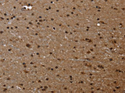 The image on the left is immunohistochemistry of paraffin-embedded Human brain  tissue using FLNA Antibody(FLNA Antibody) at dilution 1/50, on the right is treated with fusion protein. (Original magnification: ×200)Rabbit anti-Human FLNA Polyclonal Antibody