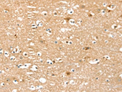 The image on the left is immunohistochemistry of paraffin-embedded Human brain tissue using PIN1 Antibody(PIN1 Antibody) at dilution 1/25, on the right is treated with fusion protein. (Original magnification: ×200)Rabbit anti-Human PIN1 Polyclonal Antibody