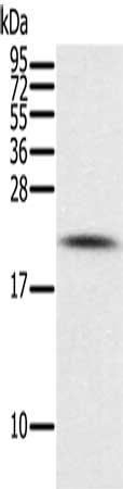 Gel: 12%SDS-PAGE, Lysate: 40 μg, Lane: Mouse brain tissue, Primary antibody: PIN1 Antibody(PIN1 Antibody) at dilution 1/300, Secondary antibody: Goat anti rabbit IgG at 1/8000 dilution, Exposure time: 1 minuteRabbit anti-Human PIN1 Polyclonal Antibody