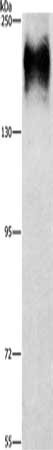 Gel: 6%SDS-PAGE, Lysate: 40 μg, Lane: HepG2 cells, Primary antibody: ATP7A Antibody(ATP7A  Antibody) at dilution 1/800, Secondary antibody: Goat anti rabbit IgG at 1/8000 dilution, Exposure time: 10 minutes