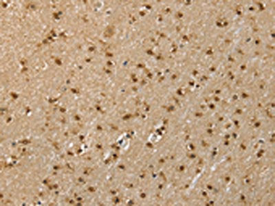 The image on the left is immunohistochemistry of paraffin-embedded Human brain  tissue using RNH1 Antibody(RNH1 Antibody) at dilution 1/40, on the right is treated with fusion protein. (Original magnification: ×200)Rabbit anti-Human RNH1 Polyclonal Antibody