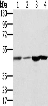 Gel: 8%SDS-PAGE, Lysate: 40 μg, Lane 1-4: Human fetal brain tissue, Human normal liver tissue, human normal kidney tissue, hepg2 cells, Primary antibody: RNH1 Antibody(RNH1 Antibody) at dilution 1/400, Secondary antibody: Goat anti rabbit IgG at 1/8000 dilution, Exposure time: 10 secondsRabbit anti-Human RNH1 Polyclonal Antibody