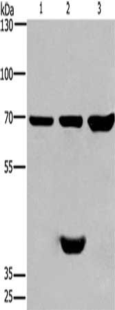 Gel: 6%SDS-PAGE, Lysate: 40 μg, Lane 1-3: Mouse brain tissue, Mouse heart tissue, mouse liver tissue, Primary antibody: CABLES1 Antibody(CABLES1 Antibody) at dilution 1/350, Secondary antibody: Goat anti rabbit IgG at 1/8000 dilution, Exposure time: 1 minute
