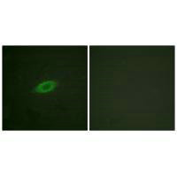 Immunofluorescence analysis of HeLa cells, treated with Forskolin (40nM, 30mins), using Annexin A6 antibody.Rabbit anti-Human ANXA6 Polyclonal Antibody