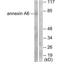 Western blot analysis of extracts from 293 cells, using Annexin A6 antibody.Rabbit anti-Human ANXA6 Polyclonal Antibody