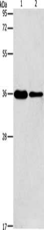 Gel: 12%SDS-PAGE, Lysate: 40 μg, Lane 1-2: A549 cells, NIH/3T3 cells, Primary antibody: AIMP2 Antibody(AIMP2 Antibody) at dilution 1/200, Secondary antibody: Goat anti rabbit IgG at 1/8000 dilution, Exposure time: 10 secondsRabbit anti-Human AIMP2 Polyclonal Antibody