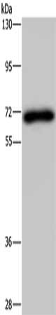 Gel: 8%SDS-PAGE, Lysate: 40 μg, Lane: Human kidney tissue, Primary antibody: NMT1 Antibody(NMT1 Antibody) at dilution 1/200, Secondary antibody: Goat anti rabbit IgG at 1/8000 dilution, Exposure time: 3 minutesRabbit anti-Human NMT1 Polyclonal Antibody