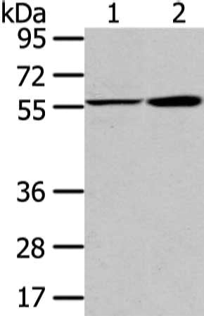 Gel: 8%SDS-PAGE, Lysate: 40 μg, Lane 1-2: A375 cell and human fetal liver tissue, Primary antibody: PPP5C Antibody(PPP5C Antibody) at dilution 1/200 dilution, Secondary antibody: Goat anti rabbit IgG at 1/8000 dilution, Exposure time: 10 secondsRabbit anti-Human PPP5C Polyclonal Antibody
