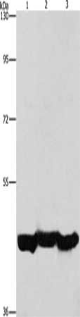 Gel: 10%SDS-PAGE, Lysate: 40 μg, Lane 1-3: A549 cells, mouse liver tissue, hepG2 cells, Primary antibody: PGK1 Antibody(PGK1 Antibody) at dilution 1/1000, Secondary antibody: Goat anti rabbit IgG at 1/8000 dilution, Exposure time: 20 secondsRabbit anti-Human PGK1 Polyclonal Antibody