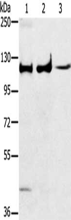 Gel: 6%SDS-PAGE, Lysate: 40 μg, Lane 1-3: Human fetal muscle tissue, A172 cells, K562 cells, Primary antibody: MAPK7 Antibody(MAPK7 Antibody) at dilution 1/250, Secondary antibody: Goat anti rabbit IgG at 1/8000 dilution, Exposure time: 20 seconds