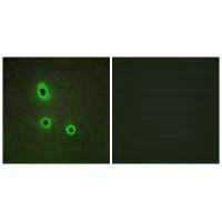 Immunofluorescence analysis of A549 cells, using EFNA5 antibody.Rabbit anti-Human EFNA5 Polyclonal Antibody