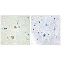 Immunohistochemistry analysis of paraffin-embedded human brain tissue using EFNA5 antibody.Rabbit anti-Human EFNA5 Polyclonal Antibody
