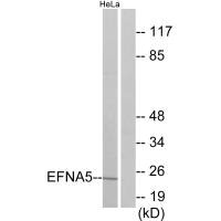 Western blot analysis of extracts from HeLa cells, using EFNA5 antibody.Rabbit anti-Human EFNA5 Polyclonal Antibody