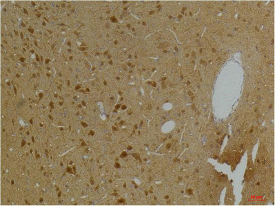Immunohistochemical analysis of paraffin-embedded Rat BrainTissue using Kv10.2 Rabbit pAb diluted at 1:200.