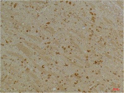 Immunohistochemical analysis of paraffin-embedded Mouse BrainTissue using Kv10.2 Rabbit pAb diluted at 1:200.