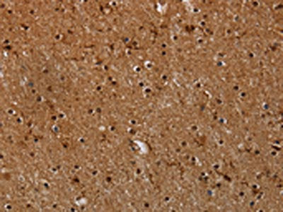The image on the left is immunohistochemistry of paraffin-embedded Human brain  tissue using MYBBP1A Antibody(MYBBP1A Antibody) at dilution 1/40, on the right is treated with synthetic peptide. (Original magnification: ×200)Rabbit anti-Human MYBBP1A Polyclonal Antibody