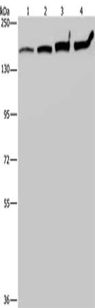 Gel: 6%SDS-PAGE, Lysate: 40 μg, Lane 1-4: HT29 cells, A549 cells, 293T cells, Hela cells, Primary antibody: MYBBP1A Antibody(MYBBP1A Antibody) at dilution 1/200, Secondary antibody: Goat anti rabbit IgG at 1/8000 dilution, Exposure time: 20 secondsRabbit anti-Human MYBBP1A Polyclonal Antibody
