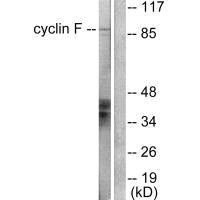 Western blot analysis of extracts from HeLa cells, using Cyclin F antibody.