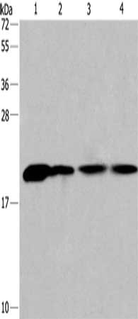 Gel: 10%SDS-PAGE, Lysate: 40 μg, Lane 1-4: Human fetal liver tissue, 293T cells, human liver cancer tissue, hela cells, Primary antibody: PPIB Antibody(PPIB Antibody) at dilution 1/450, Secondary antibody: Goat anti rabbit IgG at 1/8000 dilution, Exposure time: 20 secondsRabbit anti-Human PPIB Polyclonal Antibody