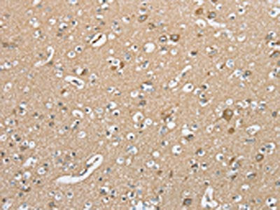 The image on the left is immunohistochemistry of paraffin-embedded Human brain tissue using the antibody Antibody) at dilution 1/20, on the right is treated with synthetic peptide. (Original magnification: ×200)