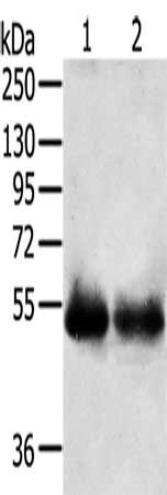 Gel: 8%SDS-PAGE, Lysate: 40 μg, Lane 1-2: Human right lung cancer tissue, Human left lung cancer tissue, Primary antibody: SERINC3 Antibody(SERINC3 Antibody) at dilution 1/200, Secondary antibody: Goat anti rabbit IgG at 1/8000 dilution, Exposure time: 5 minutes