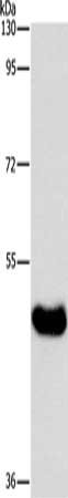 Gel: 8%SDS-PAGE, Lysate: 40 μg, Lane: Human normal liver tissue, Primary antibody: BAAT Antibody(BAAT Antibody) at dilution 1/600, Secondary antibody: Goat anti rabbit IgG at 1/8000 dilution, Exposure time: 10 seconds