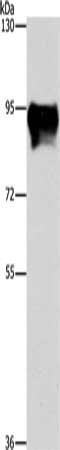 Gel: 6%SDS-PAGE, Lysate: 40 μg, Lane: Mouse brain tissue, Primary antibody: MARK1 Antibody(MARK1 Antibody) at dilution 1/300, Secondary antibody: Goat anti rabbit IgG at 1/8000 dilution, Exposure time: 30 seconds