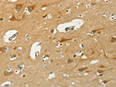 The image on the left is immunohistochemistry of paraffin-embedded Human brain  tissue using KLC1 Antibody(KLC1 Antibody) at dilution 1/40, on the right is treated with fusion protein. (Original magnification: ×200)