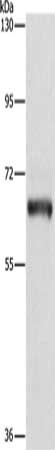Gel: 6%SDS-PAGE, Lysate: 40 μg, Lane: Lovo cells, Primary antibody: KLC1 Antibody(KLC1 Antibody) at dilution 1/500, Secondary antibody: Goat anti rabbit IgG at 1/8000 dilution, Exposure time: 5 seconds
