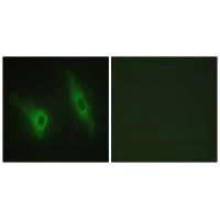 Immunofluorescence analysis of HeLa cells, using CKI-ε antibody.Rabbit anti-Human CSNK1E Polyclonal Antibody