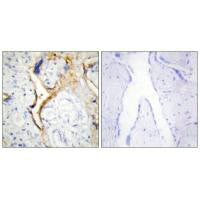 Immunohistochemistry analysis of paraffin-embedded human placenta tissue using CKI-ε antibody.Rabbit anti-Human CSNK1E Polyclonal Antibody