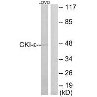 Western blot analysis of extracts from LOVO cells, using CKI-ε antibody.Rabbit anti-Human CSNK1E Polyclonal Antibody