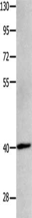 Gel: 10%SDS-PAGE, Lysate: 40 μg, Lane: Human brain glioma tissue, Primary antibody: MAGEB4 Antibody(MAGEB4 Antibody) at dilution 1/550, Secondary antibody: Goat anti rabbit IgG at 1/8000 dilution, Exposure time: 2 minutes