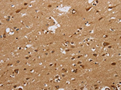 The image on the left is immunohistochemistry of paraffin-embedded Human brain tissue using the antibody Antibody) at dilution 1/20, on the right is treated with synthetic peptide. (Original magnification: ×200)