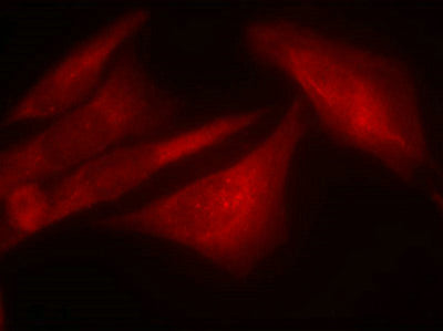 Immunofluorescence staining of methanol-fixed Hela cells using G3BP-1(Phospho-Ser232) Antibody.Rabbit anti-Human G3BP1 Polyclonal Antibody