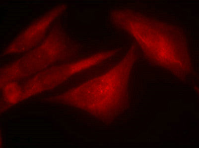 Immunofluorescence staining of methanol-fixed Hela cells using G3BP-1(Phospho-Ser232) Antibody.Rabbit anti-Human G3BP1 Polyclonal Antibody