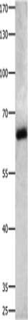 Gel: 8%SDS-PAGE, Lysate: 40 μg, Lane: Jurkat cells, Primary antibody: IGF2BP2 Antibody(IGF2BP2 Antibody) at dilution 1/300, Secondary antibody: Goat anti rabbit IgG at 1/8000 dilution, Exposure time: 40 secondsRabbit anti-Human IGF2BP2 Polyclonal Antibody