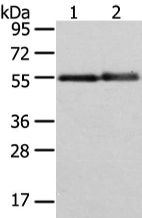 Gel: 8%SDS-PAGE, Lysate: 40 μg, Lane 1-2: Human normal liver and placenta tissue, Primary antibody: XK Antibody(XK  Antibody) at dilution 1/350 dilution, Secondary antibody: Goat anti rabbit IgG at 1/8000 dilution, Exposure time: 2 minutes