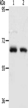 Gel: 8%SDS-PAGE, Lysate: 40 μg, Lane 1-2: Human fetal kidney tissue, Human fetal lung tissue, Primary antibody: ACOT11 Antibody(ACOT11 Antibody) at dilution 1/450, Secondary antibody: Goat anti rabbit IgG at 1/8000 dilution, Exposure time: 90 seconds