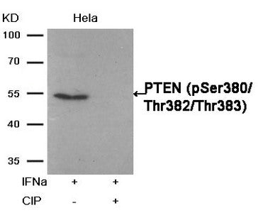 Western blot analysis of extracts from Hela cells, treated with IFNa or calf intestinal phosphatase (CIP), using PTEN (Phospho-Ser380/Thr382/Thr383) Antibody.Rabbit anti-Human PTEN Polyclonal Antibody