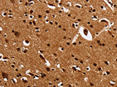 The image is immunohistochemistry of paraffin-embedded Human brain tissue using the antibody Antibody) at dilution 1/25. (Original magnification: ×200)Rabbit anti-Human UPK3B Polyclonal Antibody