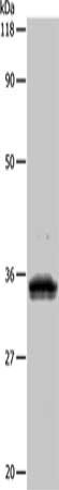 Gel: 10%SDS-PAGE, Lysate: 40 μg, Lane: 293T cells, Primary antibody: UPK3B Antibody(UPK3B Antibody) at dilution 1/1000, Secondary antibody: Goat anti rabbit IgG at 1/8000 dilution, Exposure time: 1 minuteRabbit anti-Human UPK3B Polyclonal Antibody